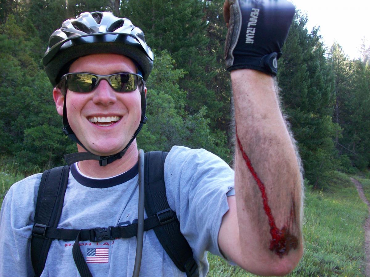 A smiling man wearing a bicycle helmet and sunglasses shows his injured arm, which has a visible cut with some blood, while standing in a wooded area. Colorado Trail mountain bike trail.