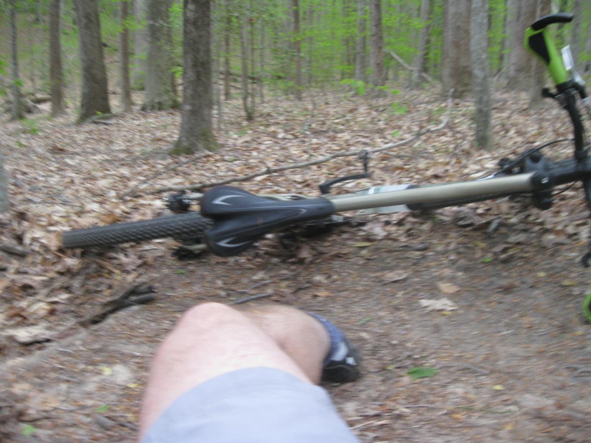 A close-up view of a fallen mountain bike on a trail surrounded by trees and scattered leaves. A person's leg in shorts can be seen in the foreground, indicating an outdoor biking experience. The background features a blurred view of the wooded area. Beaverdam Park mountain bike trail.