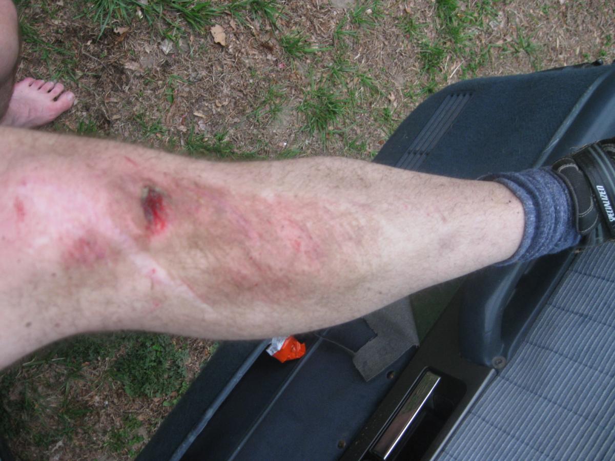A close-up view of a person's leg with visible scratches and abrasions on the knee and lower part of the leg, displaying signs of dirt and injury. The individual is barefoot, and part of a vehicle is visible in the background. The setting appears to be outdoors with grass and dirt around. Beaverdam Park mountain bike trail.