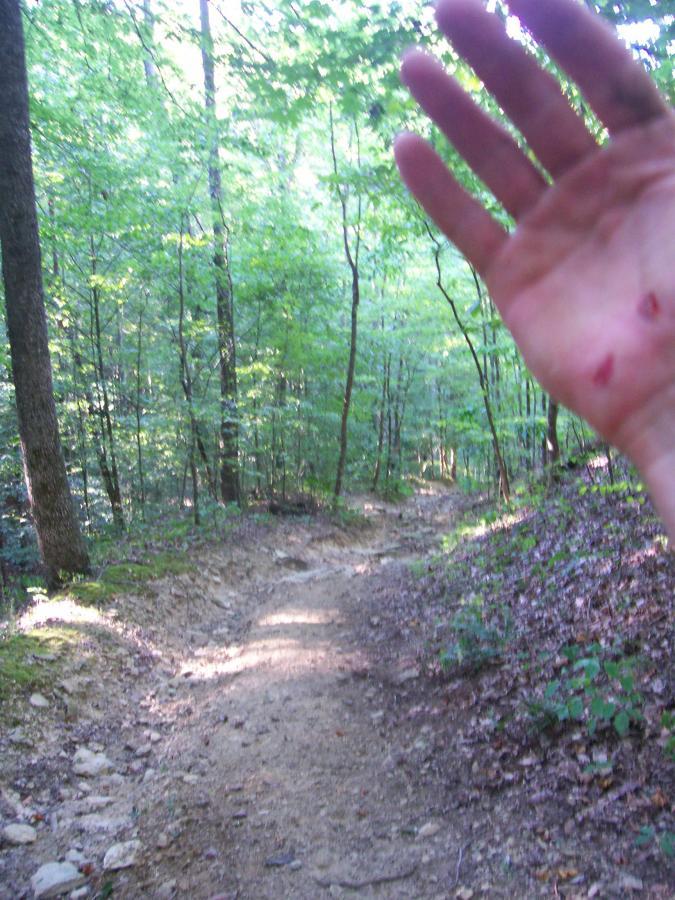 A hiking trail surrounded by lush green trees, with a visible hand in the foreground showing small cuts. The trail winds through the forest, indicating a natural, wooded environment. Green River mountain bike trail.