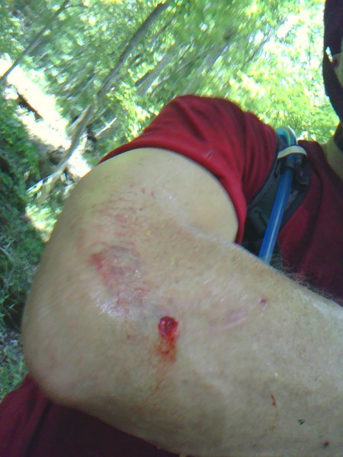 A close-up image of a person's arm showing an injured elbow with some bleeding and visible abrasions, set against a blurred natural background with trees. The person is wearing a red shirt and appears to be outdoors, possibly after an accident or fall. O'bannon Woods mountain bike trail.