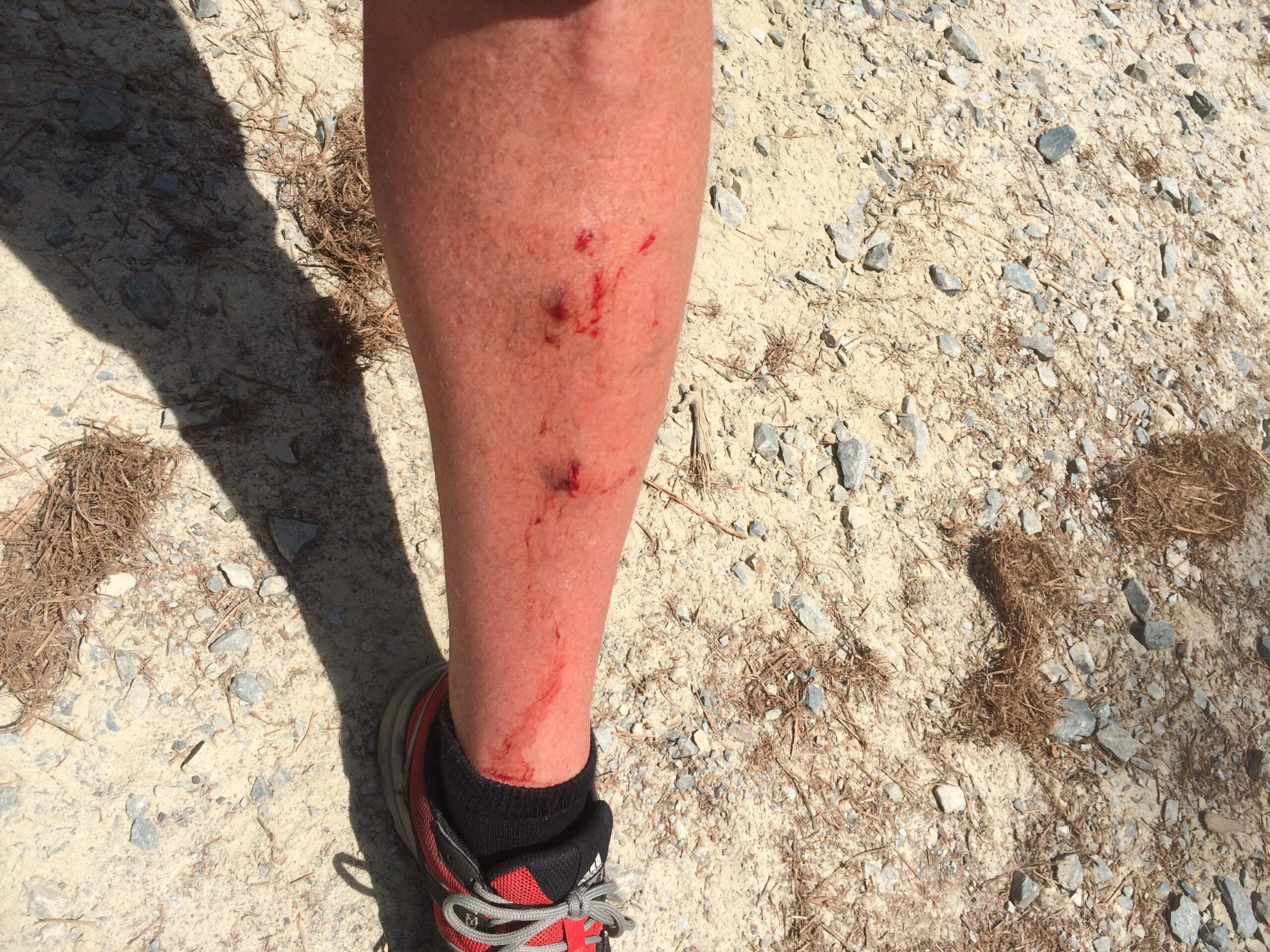 Vassago Jabberwocky: A close-up image of a leg with several cuts and abrasions, showing blood, against a background of dry, rocky ground with scattered debris. The leg is partially covered by a running shoe.