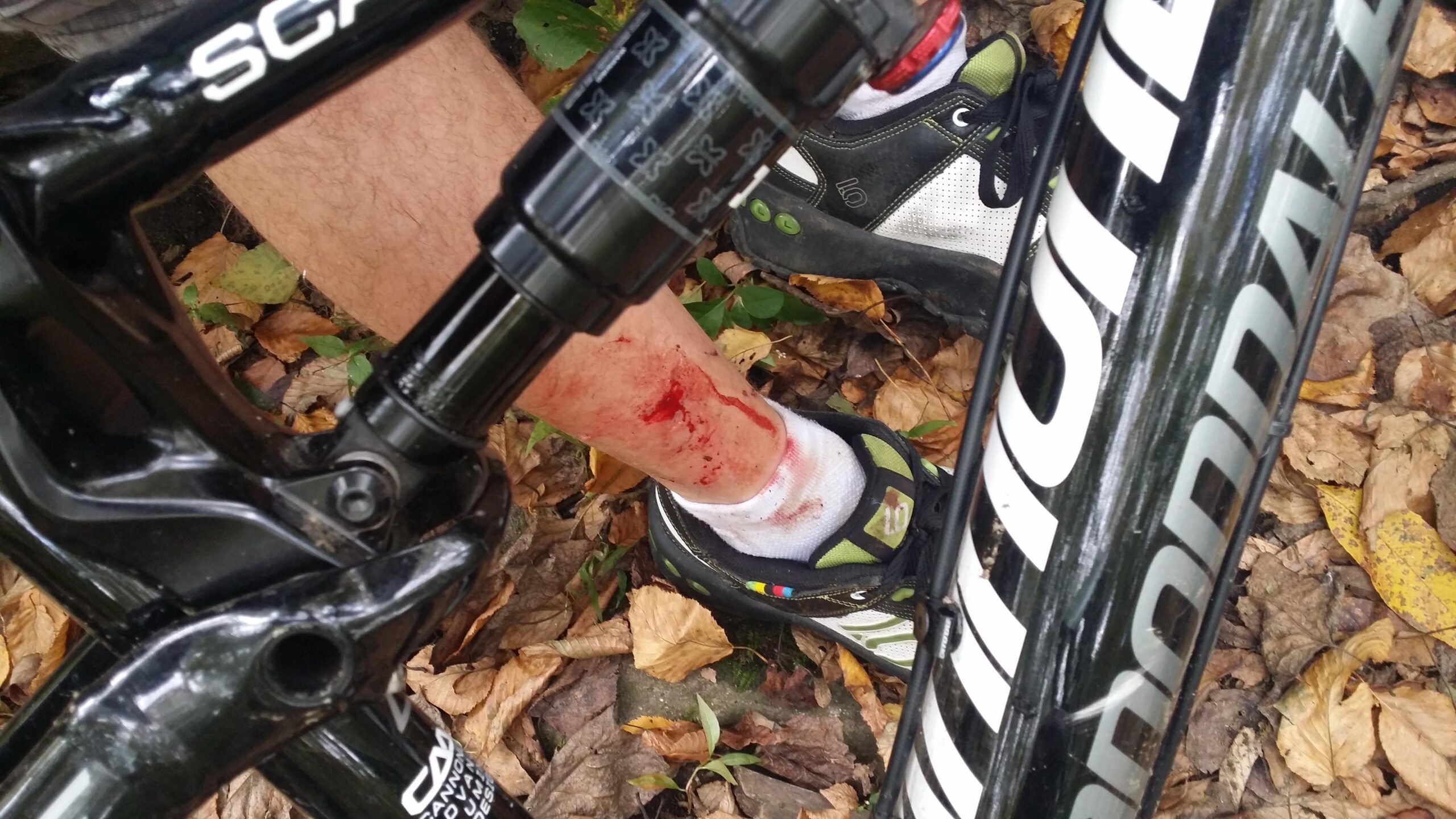 Cannondale Scalpel 29er 2: A close-up of a cyclist's leg showing a bleeding injury on the ankle, with a bike frame partially visible in the foreground. The ground is covered with dry leaves, indicating an outdoor setting. The cyclist is wearing a sock and cycling shoe, and the image captures a moment of distress from a biking accident.