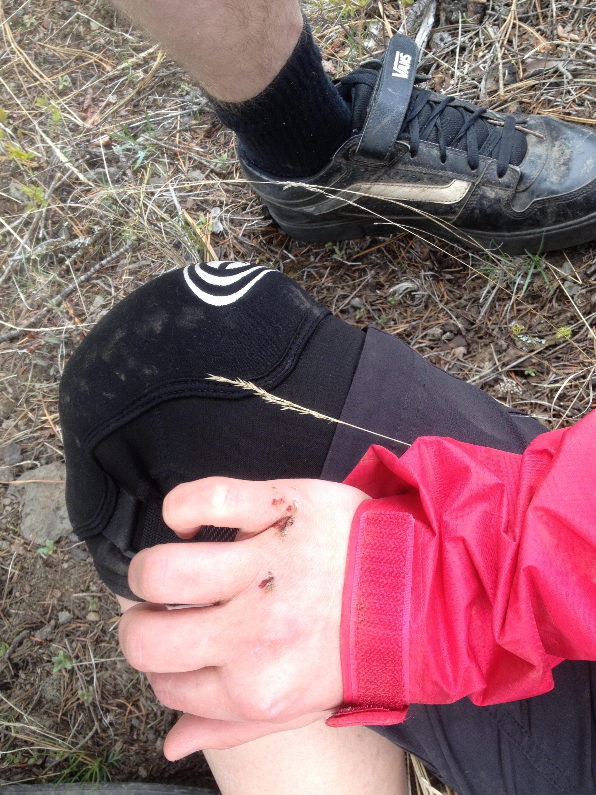 A close-up image of a hand showing minor scratches and dirt, resting on a leg covered with black athletic shorts. In the background, a partially visible leg in a black sock and a dirty shoe can be seen, along with some grass and dirt on the ground. The hand is also wearing a red jacket cuff. Smith Creek mountain bike trail.