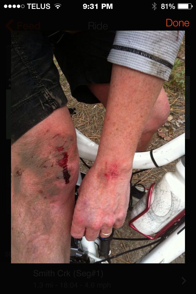 A close-up image of a person's injured leg and hand, showing cuts and bruises. The leg is resting on a bicycle, with visible dirt and blood on the shin and knee area. The hand appears to be gripping the bicycle frame, and the surrounding background shows a natural outdoor setting. Smith Creek mountain bike trail.