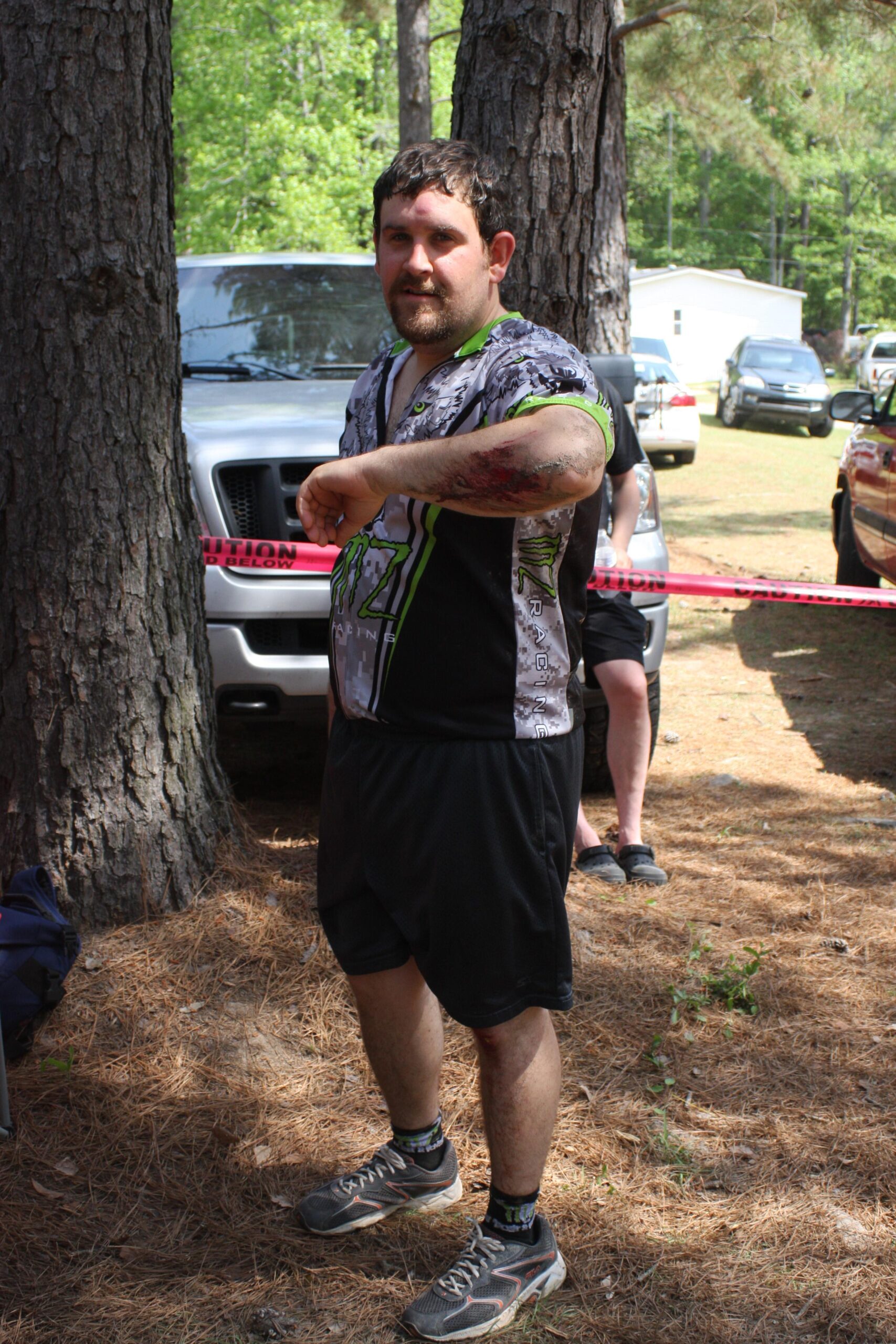 A man with a beard stands outdoors, wearing a colorful short-sleeve shirt and black shorts. He has visible injuries on his arm and appears to be demonstrating or checking the injuries. A grey vehicle is parked in the background, and there are trees surrounding the area. Mt. Zion Bike Trails mountain bike trail.
