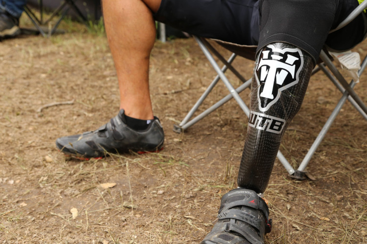 A close-up view of a person's leg with a black carbon fiber prosthetic limb featuring a logo, sitting on a grassy surface next to a folding chair. The person is wearing a cycling shoe on their other foot, and part of their leg is visible, indicating they are in a casual outdoor setting.