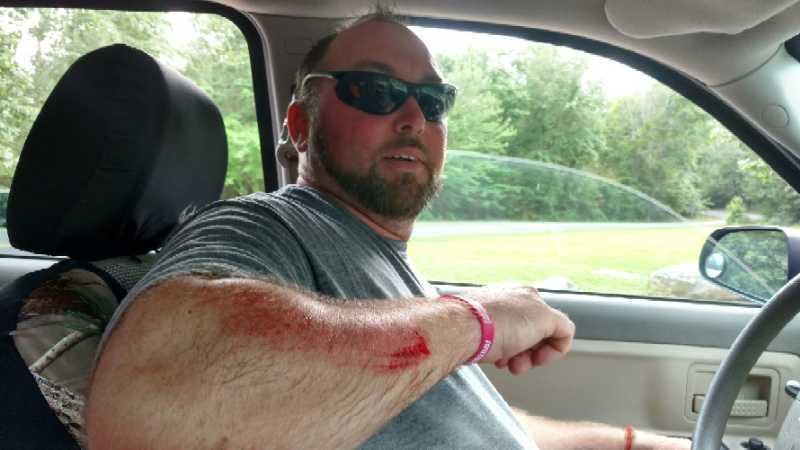 A man sitting in the driver's seat of a vehicle, wearing sunglasses and a gray t-shirt, looks towards the camera. His left arm is visible, showing a bruise and some blood on the skin. The background features greenery and an open area outside the car. DeSoto State Park mountain bike trail.