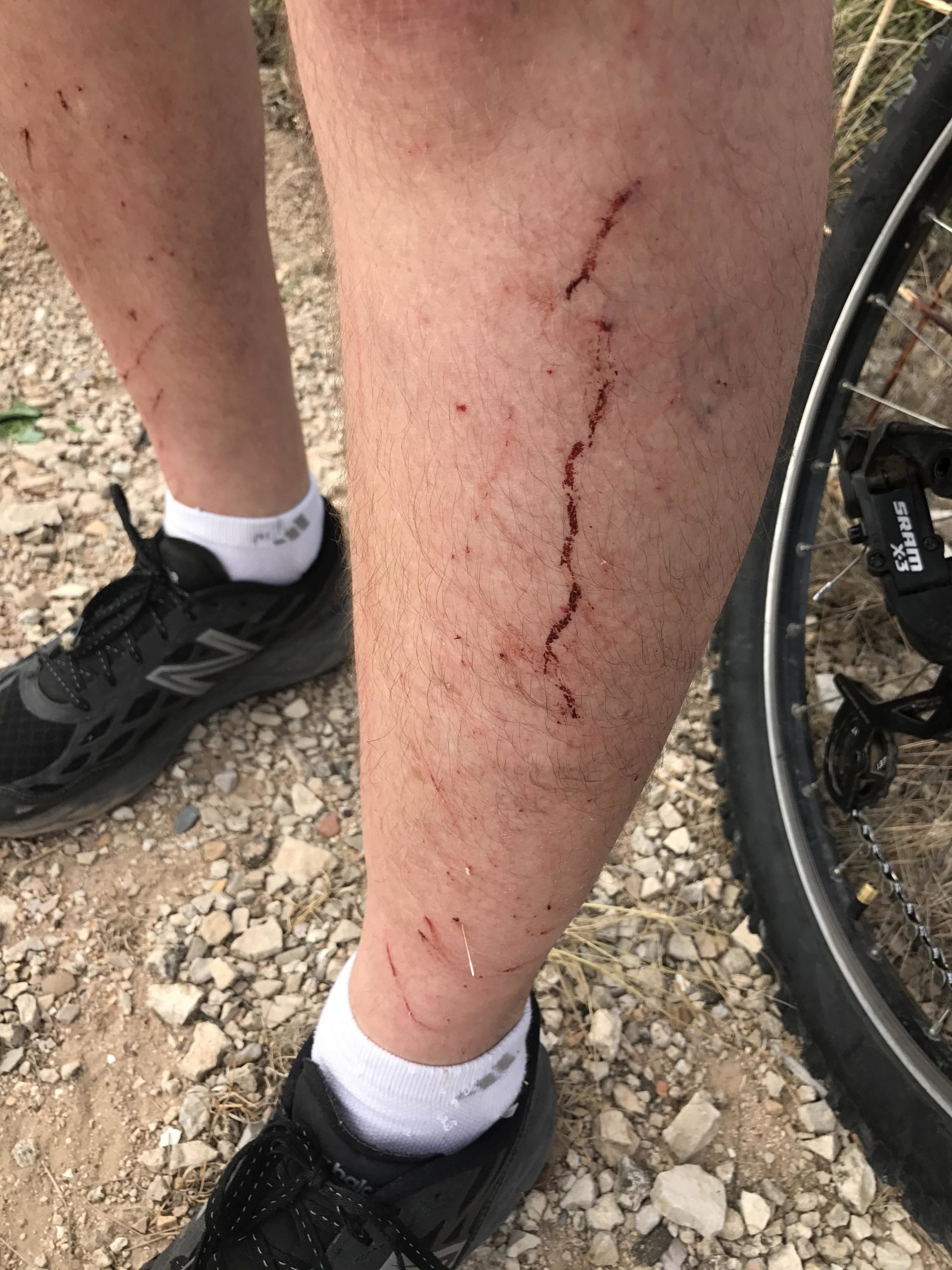 A close-up image of a person